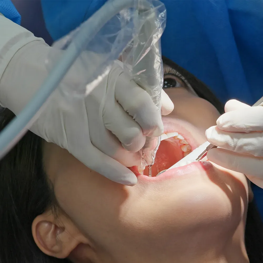 Is Root Canal painful?
