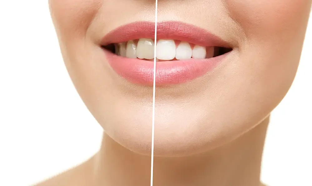 Maintaining Your Results