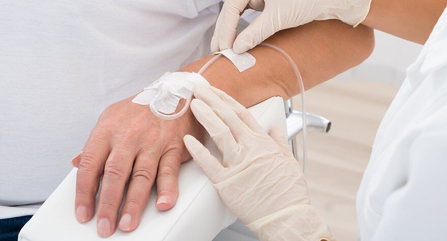 Types of Sedation