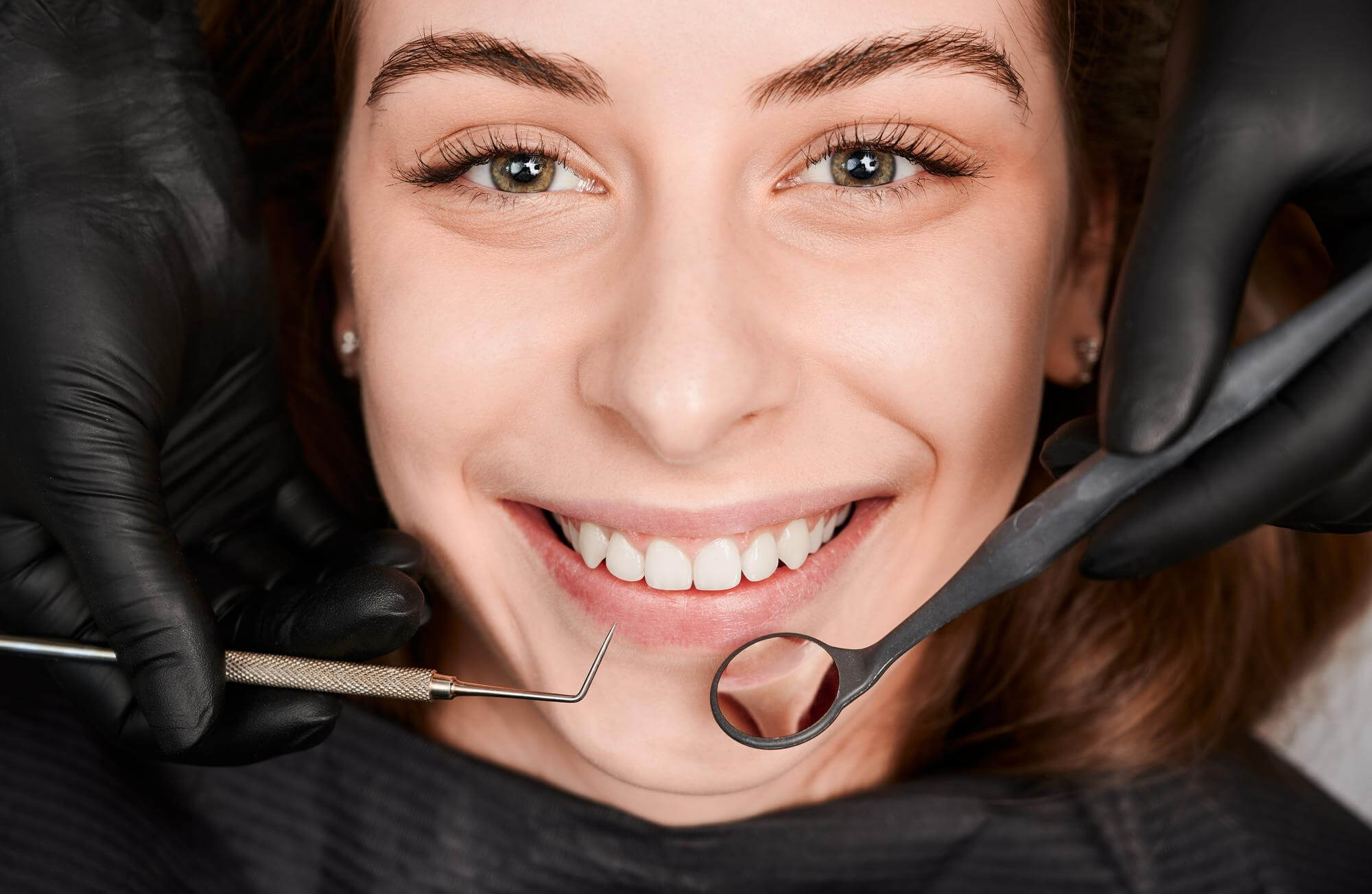 Teeth Whitening What to Know Before You Start at Alaska Dental Arts Muldoon