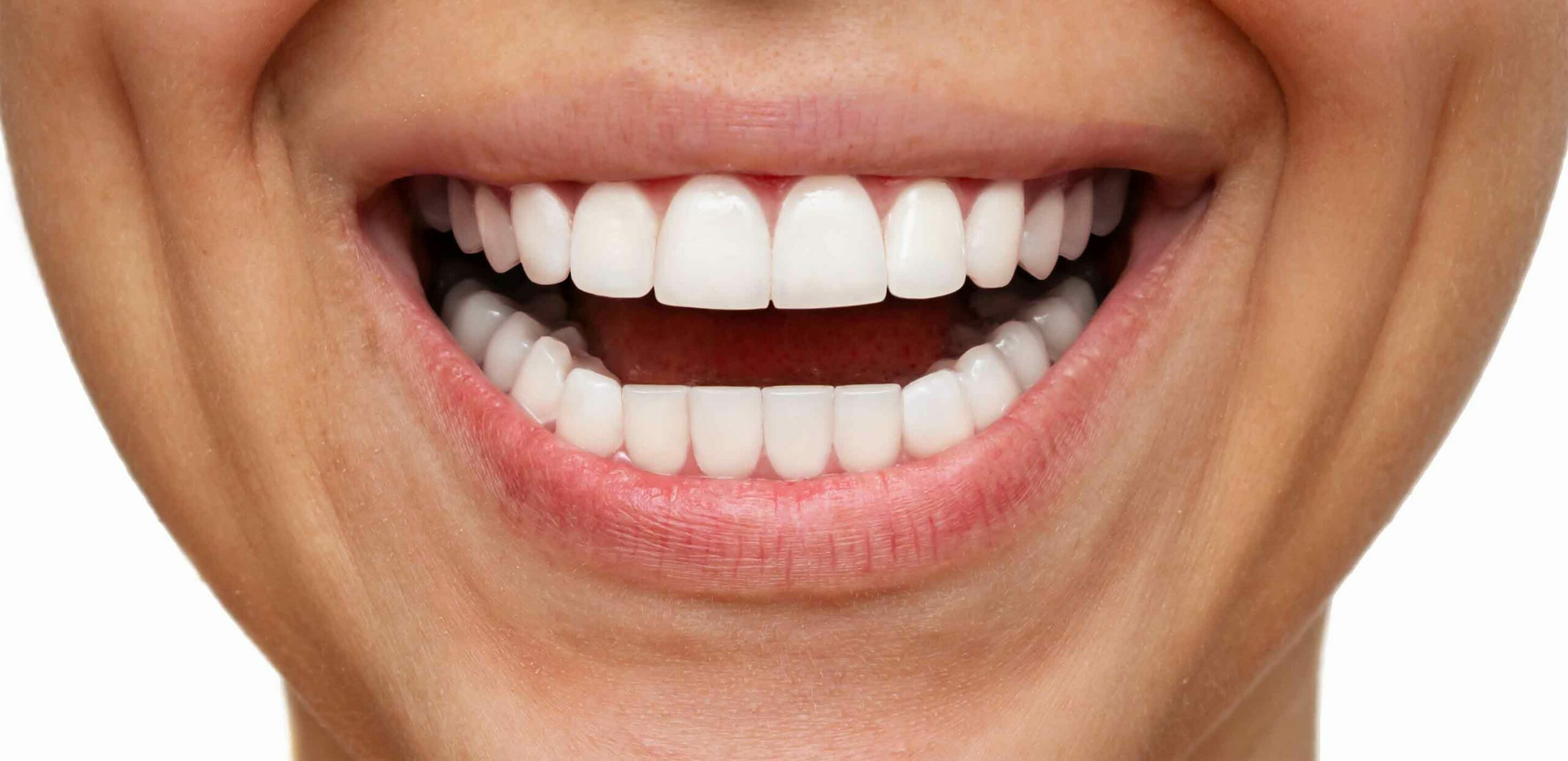 Good Teeth