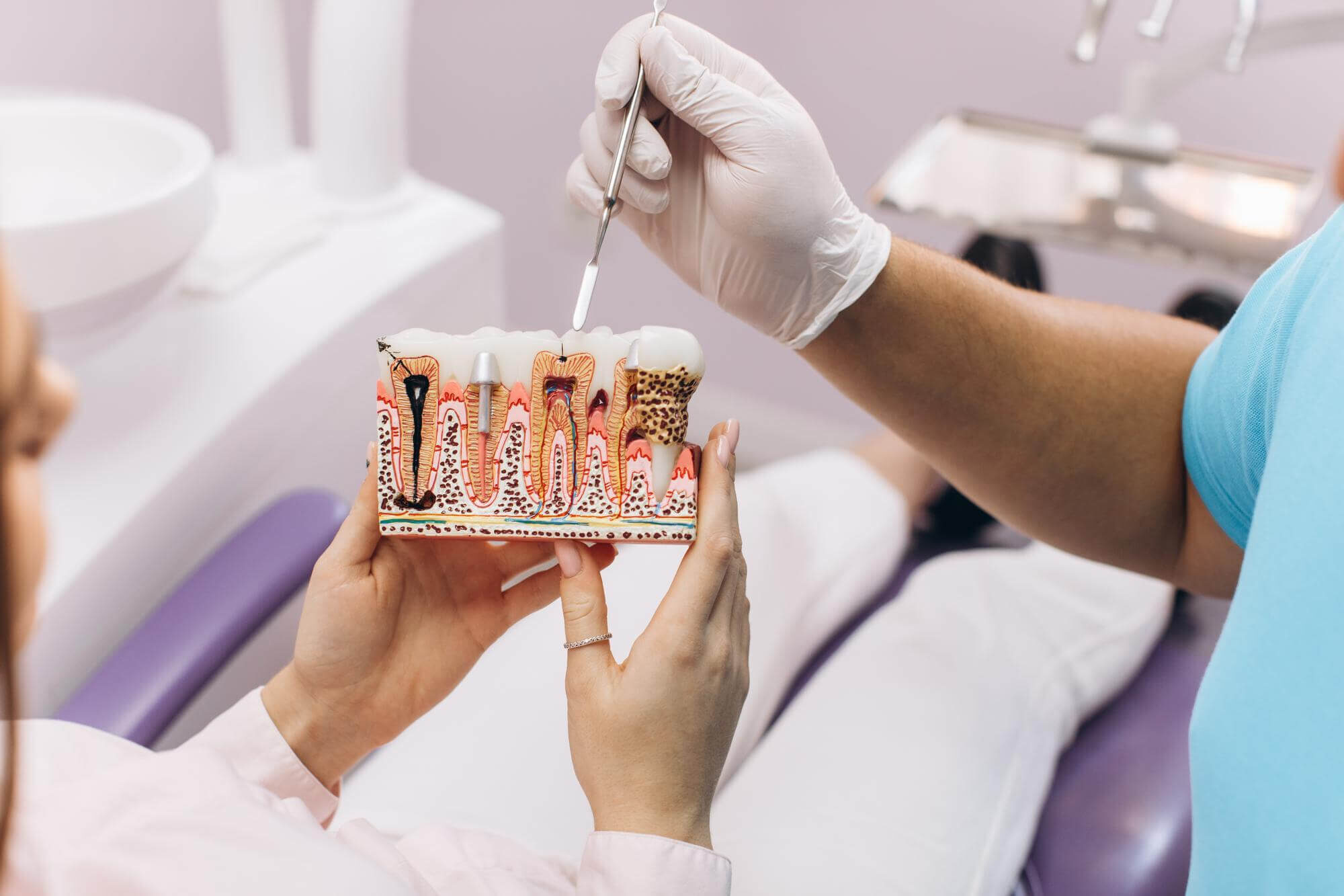 Root Canal At Muldoon Dental Arts
