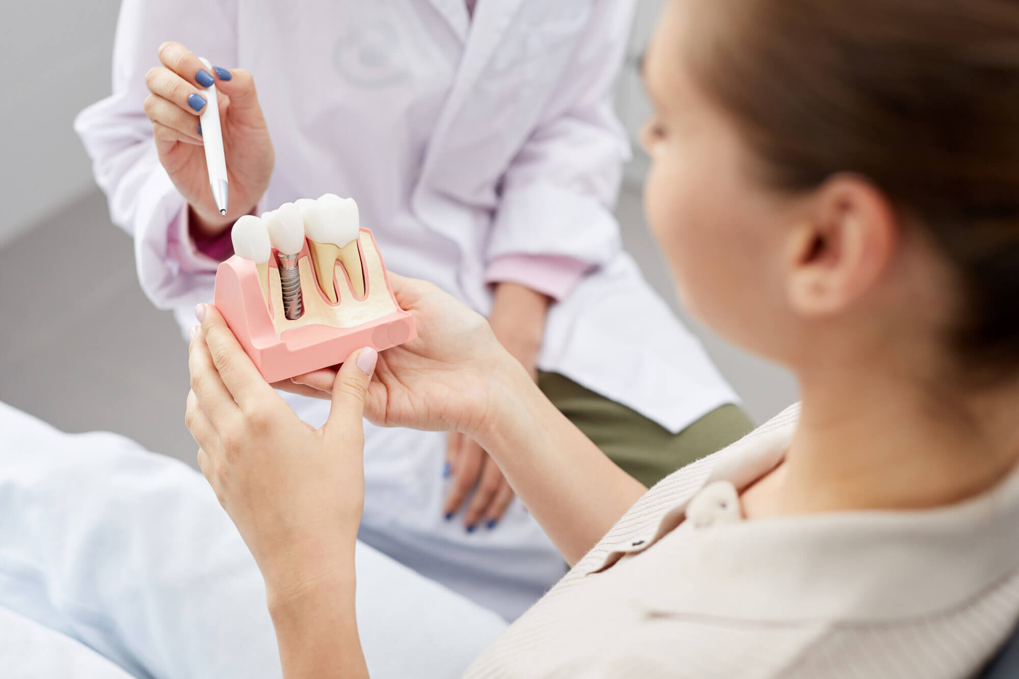 Dental Implants At Muldoon Dental Arts